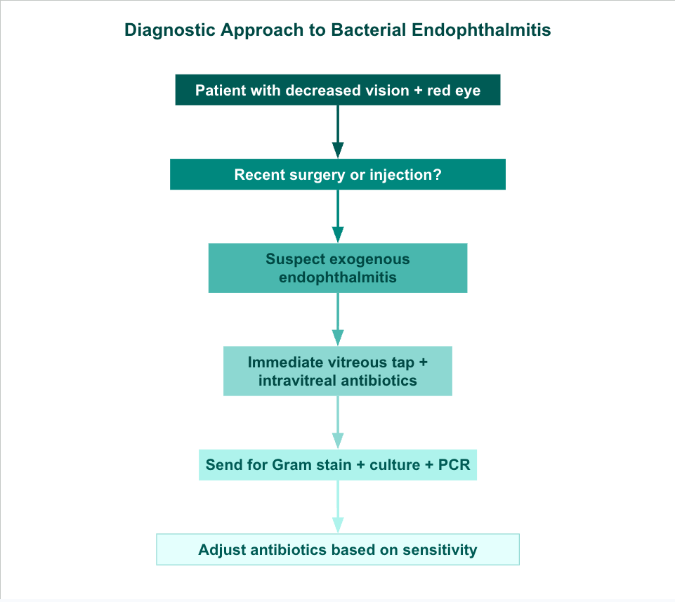 <p>Diagnostic Approach to Bacterial Endophthalmitis