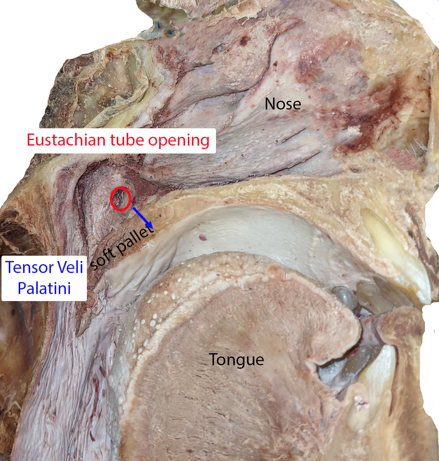 <p>Anatomical Relationships of the Tensor Veli Palatini and Pharyngeal Orifice