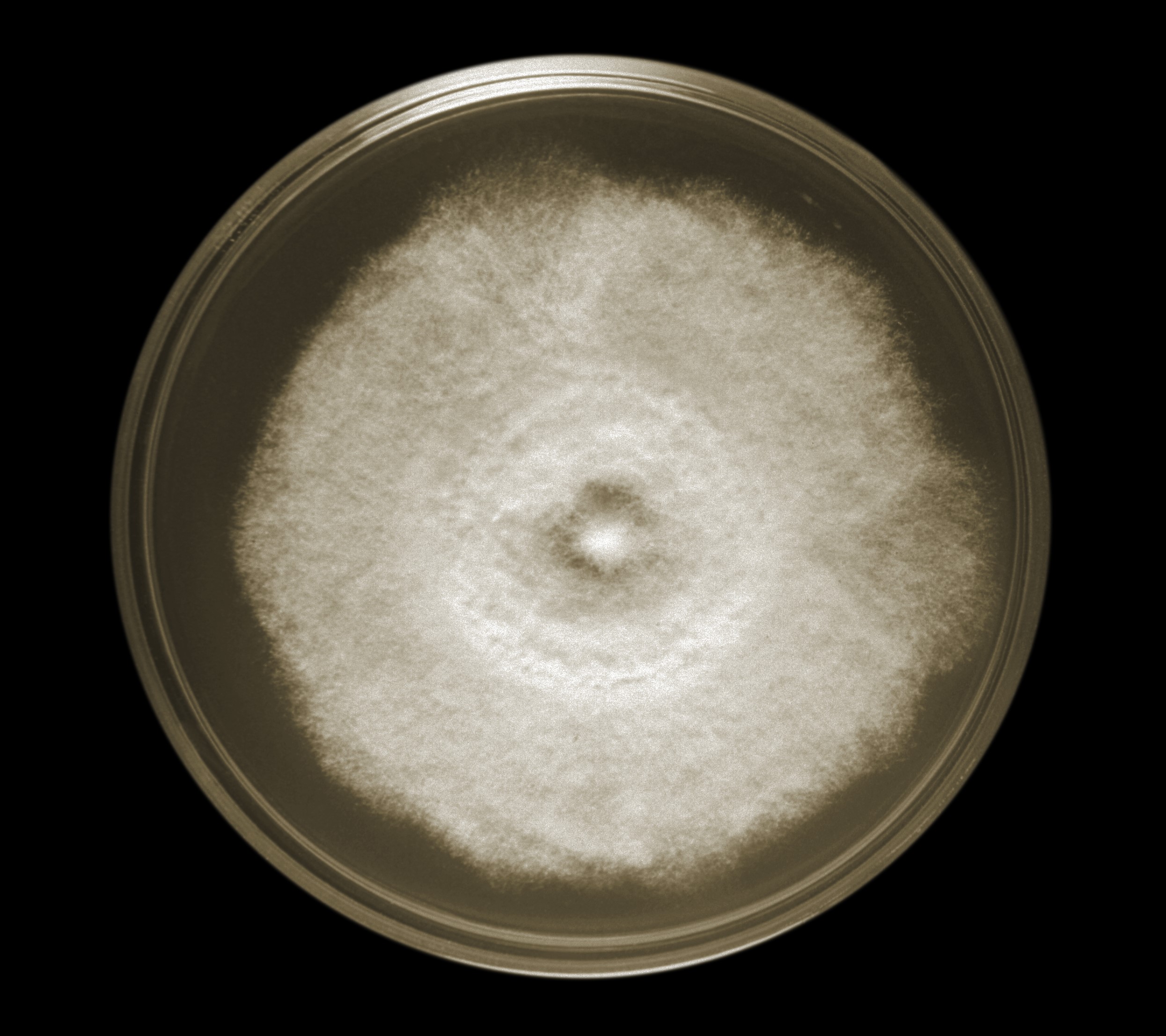 <p>Blastomycosis Culture