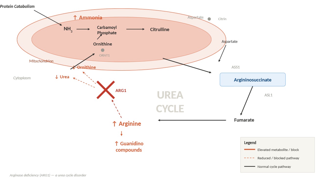 <p>Urea Cycle Disorder: Arginase Deficiency