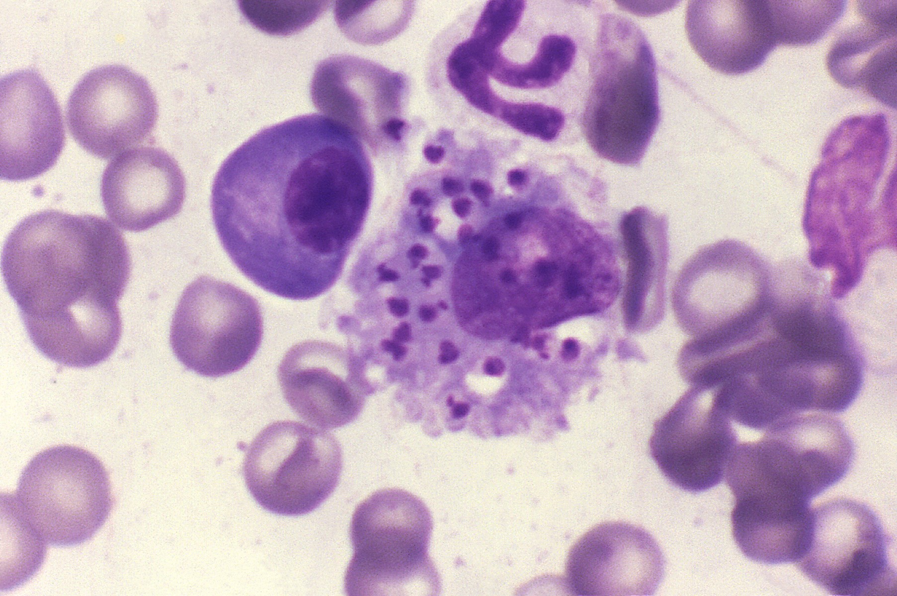 <p><em>Leishmania donovani</em> Amastigotes in a Bone Marrow Histiocyte
