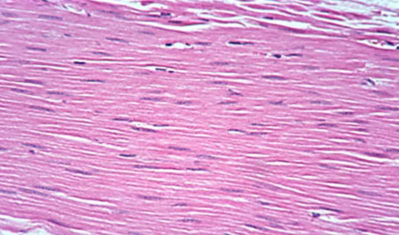 <p>Smooth Muscle.</p>