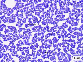 <p>Gram Stain of <em>Staphylococcus aureus.</em></p>