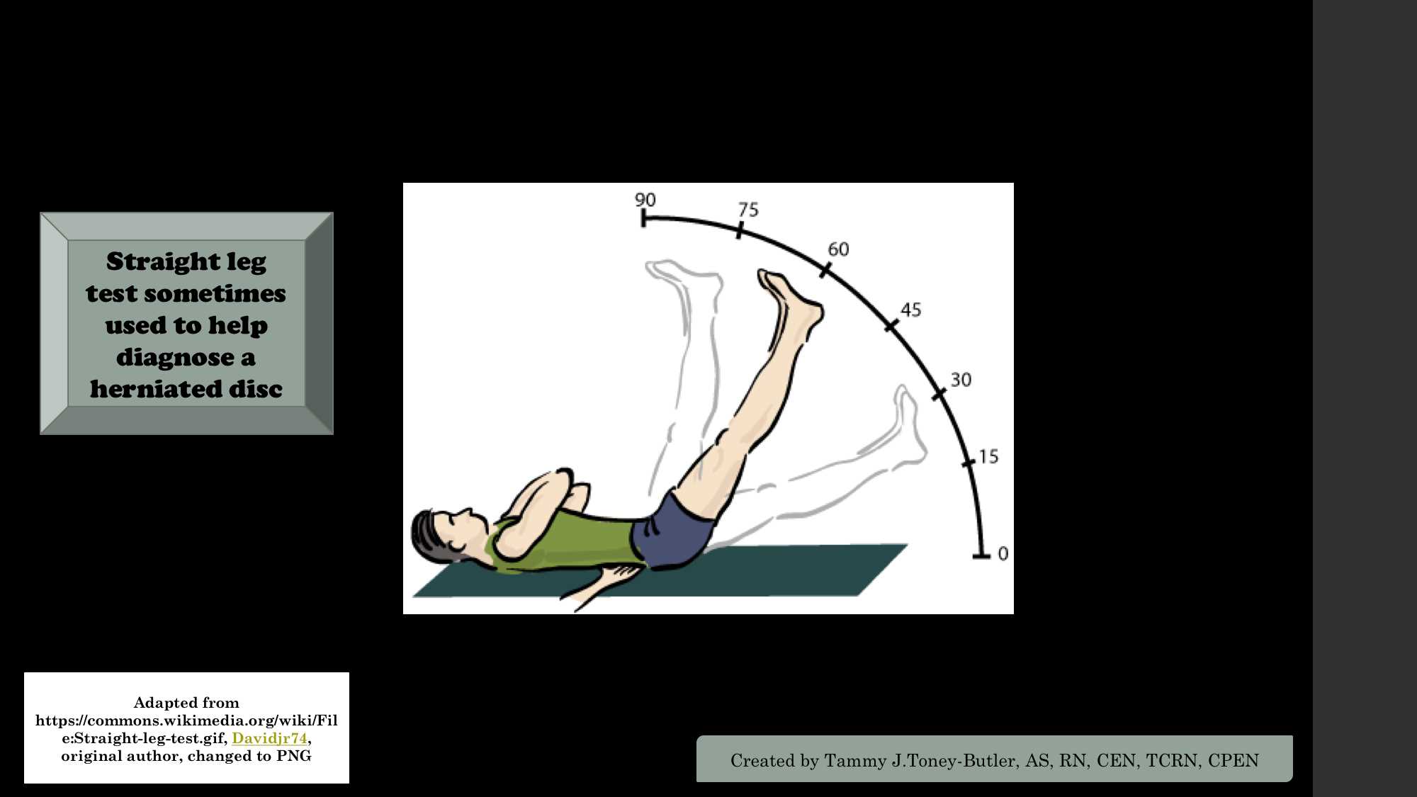 <p>Straight-Leg Test. The straight-leg test is used to diagnose a herniated disk.</p>