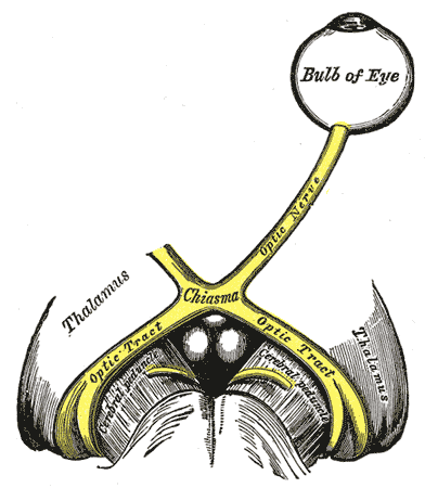 <p>Left Optic Nerve and Optic Tracts