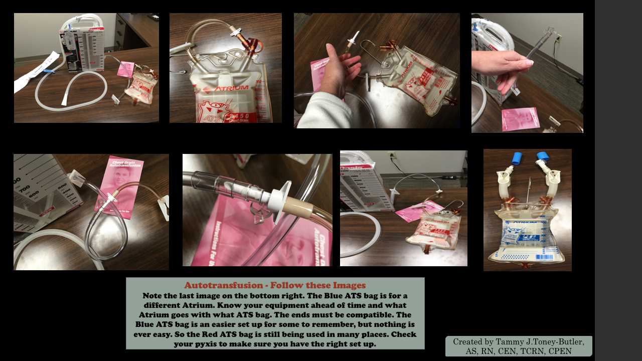 <p>Autotransfusion Set Up.&nbsp;</p>