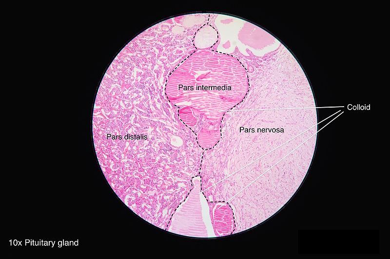 <p>Microscopic Anatomy of the Hypophysis