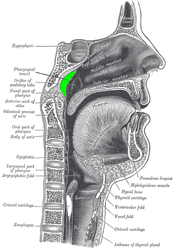 <p>Sagittal Section of Nose, Mouth, Pharynx, and Larynx with Adenoid Hypertrophy