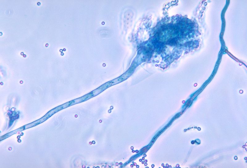<p><em>Aspergillus Fumigatus