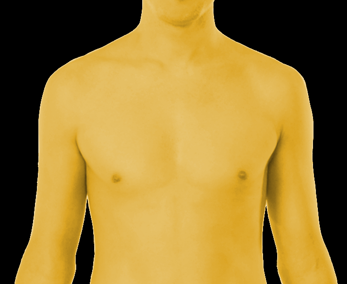 <p>Jaundice in a Male.</p>