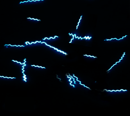 <p>Borrelia Appearance in Dark Field Microscopy.</p>