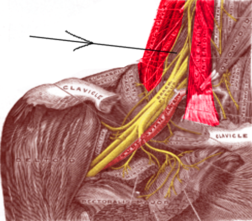 <p>Interscalene Block Regional Landmarks
