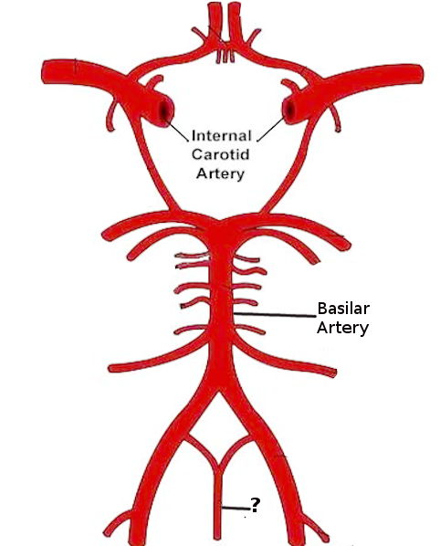 <p>Anterior Spinal Artery
