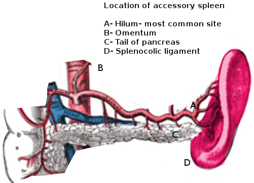 <p>Accessory Spleen.</p>