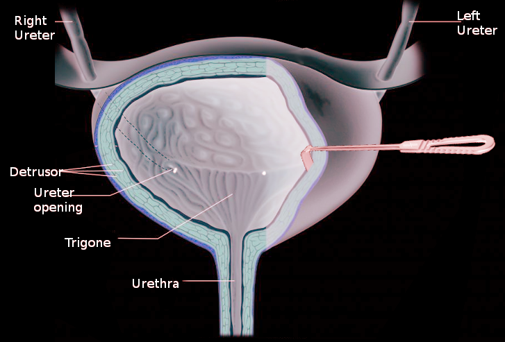 <p>Detrusor Muscle.</p>