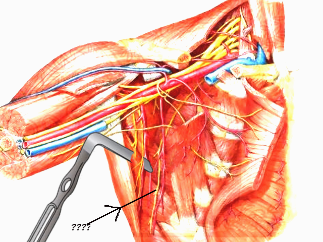 <p>Long Thoracic Nerve.</p>