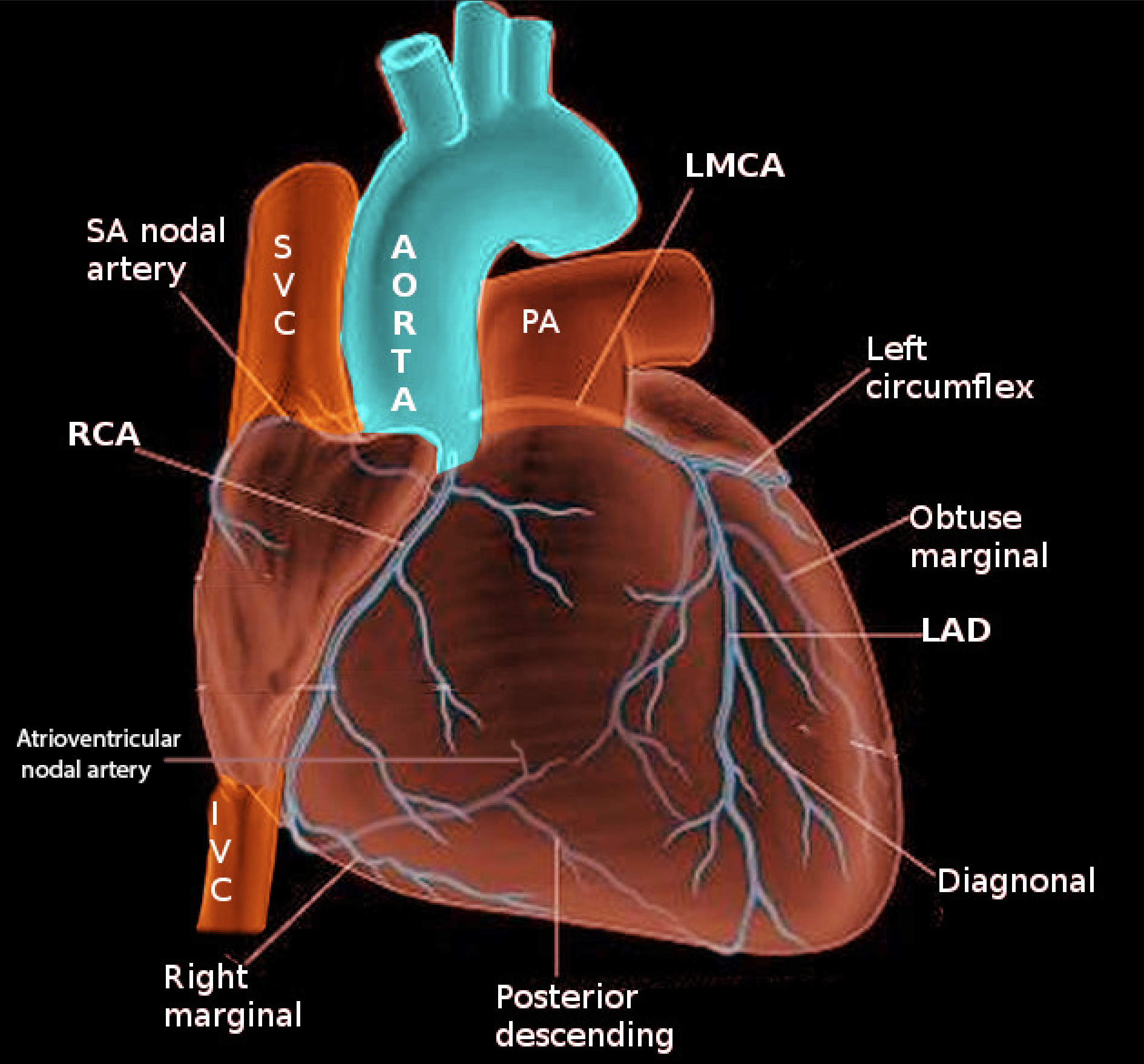 <p>Coronary Arteries.</p>
