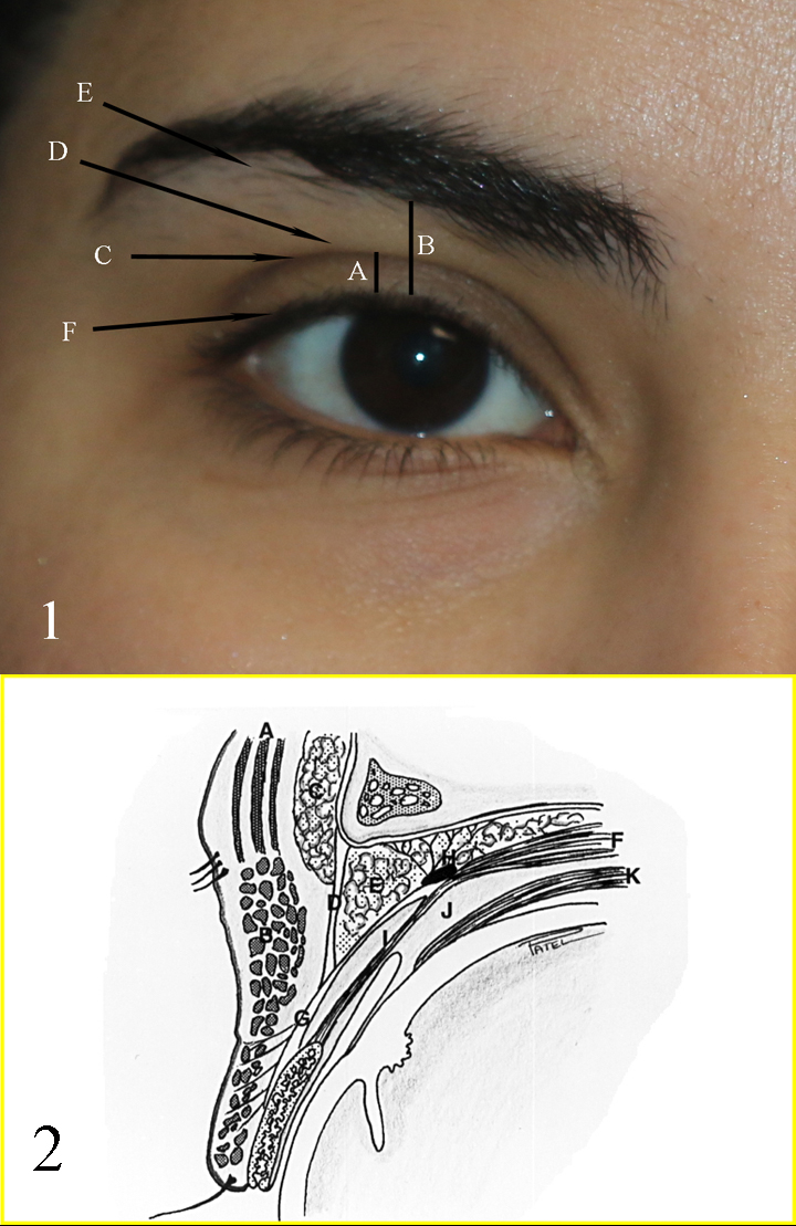 <p>Eyelid Landmarks and Aesthetic Units and Anatomy of the Upper Eyelid and Brow Complex