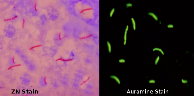 <p>Acid-Fast Bacteria.</p>