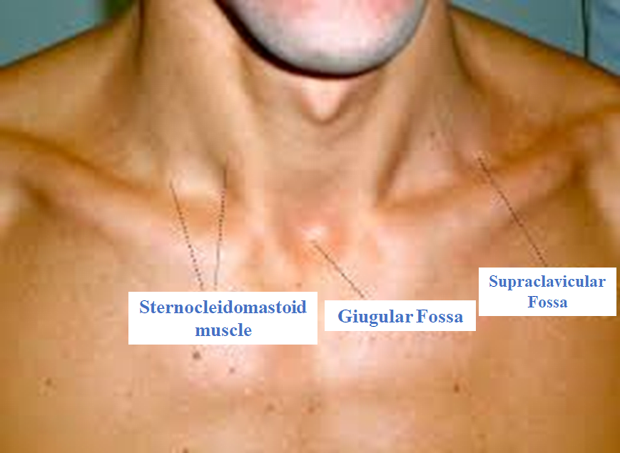 <p>Surface Landmarks of the Lower Neck and Upper Thorax