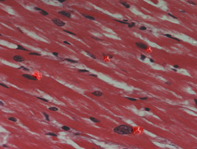 <p>Lipofuscin in Muscle.</p>