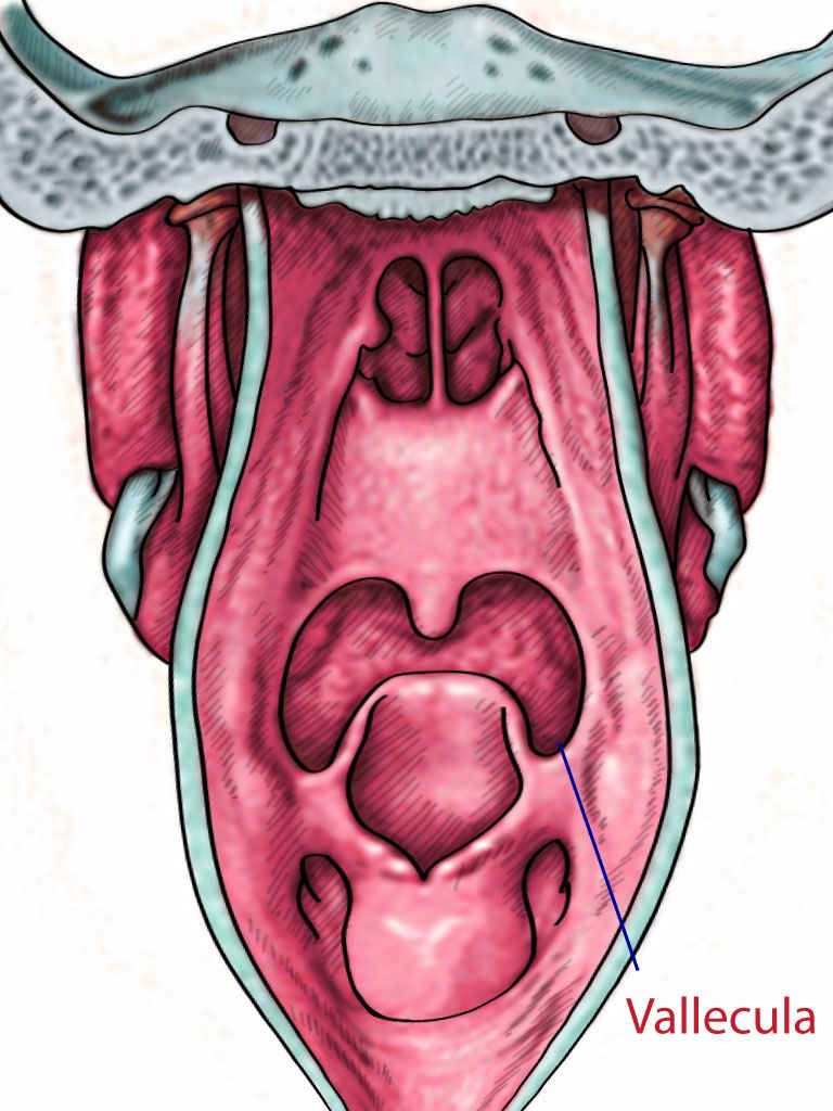 <p>Vallecula.</p>