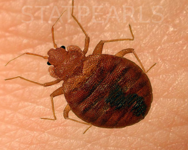 <p>Bed Bug on Human Skin