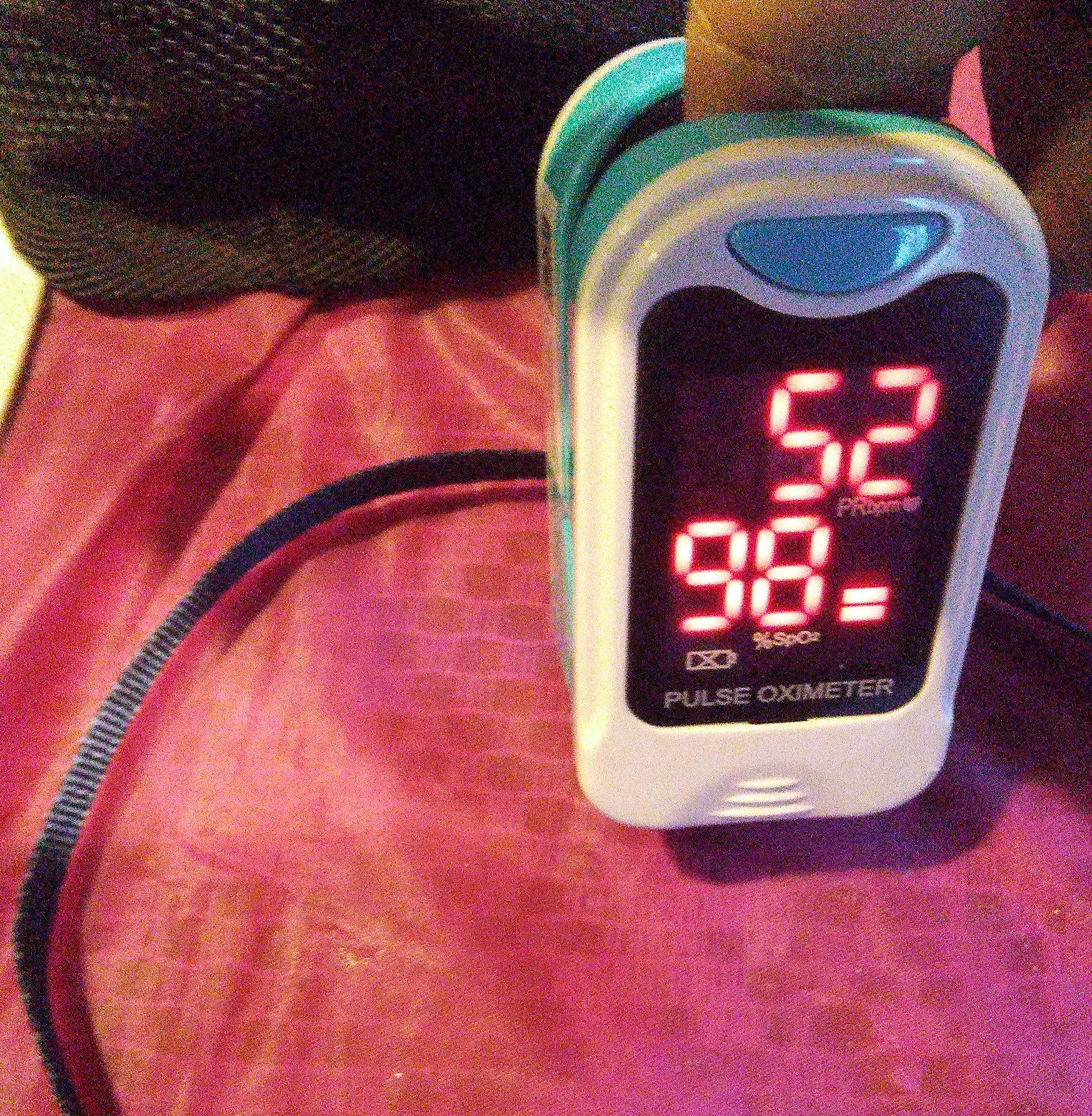 <p>Pulse Oximeter.&nbsp;This image of a pulse oximeter shows 98% oxygen saturation level and a heart rate of 52 bpm.</p>