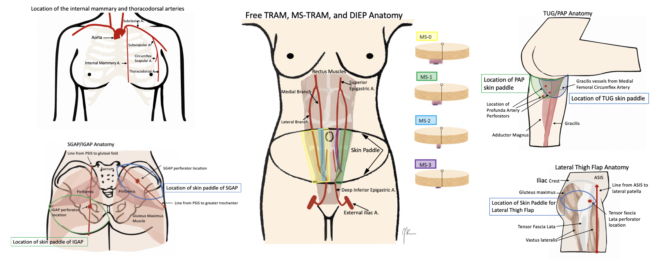 <p>Anatomy of Donor and Recipient Sites for Breast Reconstruction.</p>