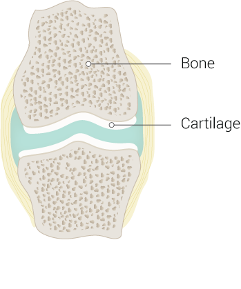<p>Cartilage and Bone Illustration.</p>