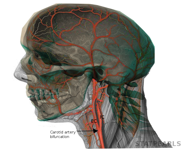 <p>Carotid Artery Bifurcation and Intracranial Circulation